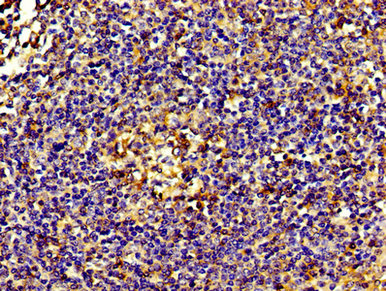 EIF3D Antibody - IHC image of EIF3D Antibody diluted at 1:200 and staining in paraffin-embedded human tonsil tissue performed on a Leica BondTM system. After dewaxing and hydration, antigen retrieval was mediated by high pressure in a citrate buffer (pH 6.0). Section was blocked with 10% normal goat serum 30min at RT. Then primary antibody (1% BSA) was incubated at 4°C overnight. The primary is detected by a biotinylated secondary antibody and visualized using an HRP conjugated SP system.