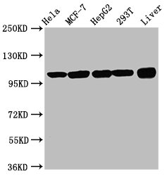 EIF3D Antibody - Western Blot Positive WB detected in: K562 whole cell lysate, HL60 whole cell lysate, Hela whole cell lysate, MCF-7 whole cell lysate, HepG2 whole cell lysate, Rat liver tissue, Mouse brain tissue, Mouse lung tissue All lanes: EIF3D antibody at 2µg/ml Secondary Goat polyclonal to rabbit IgG at 1/50000 dilution Predicted band size: 64, 59, 63 kDa Observed band size: 64 kDa