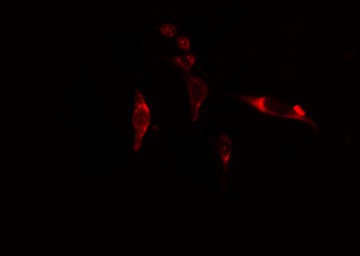 EIF3D Antibody - Staining NIH-3T3 cells by IF/ICC. The samples were fixed with PFA and permeabilized in 0.1% Triton X-100, then blocked in 10% serum for 45 min at 25°C. The primary antibody was diluted at 1:200 and incubated with the sample for 1 hour at 37°C. An Alexa Fluor 594 conjugated goat anti-rabbit IgG (H+L) antibody, diluted at 1/600, was used as secondary antibody.