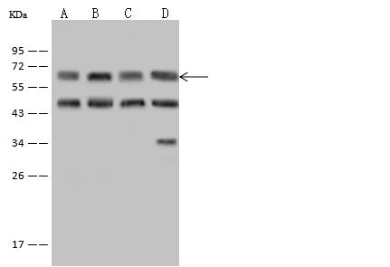EIF3D Antibody - Anti-EIF3D rabbit polyclonal antibody at 1:500 dilution. Lane A: PC12 Whole Cell Lysate. Lane B: HeLa Whole Cell Lysate. Lane C: 293T Whole Cell Lysate. Lane D: U-251 MG Whole Cell Lysate. Lysates/proteins at 30 ug per lane. Secondary: Goat Anti-Rabbit IgG (H+L)/HRP at 1/10000 dilution. Developed using the ECL technique. Performed under reducing conditions. Predicted band size: 64 kDa. Observed band size: 64 kDa. (We are unsure as to the identity of these extra bands.)