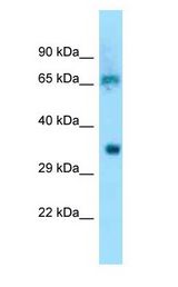 EIF3D Antibody - EIF3D antibody Western Blot of Rat liver.  This image was taken for the unconjugated form of this product. Other forms have not been tested.