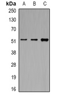 EIF3E Antibody - Western blot analysis of eIF3E expression in MCF7 (A); K562 (B); HepG2 (C) whole cell lysates.