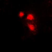 EIF3E Antibody - Immunofluorescent analysis of eIF3E staining in HeLa cells. Formalin-fixed cells were permeabilized with 0.1% Triton X-100 in TBS for 5-10 minutes and blocked with 3% BSA-PBS for 30 minutes at room temperature. Cells were probed with the primary antibody in 3% BSA-PBS and incubated overnight at 4 deg C in a humidified chamber. Cells were washed with PBST and incubated with a DyLight 594-conjugated secondary antibody (red) in PBS at room temperature in the dark.