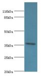 EIF3G Antibody - Western blot. All lanes: Eukaryotic translation initiation factor 3 subunit G antibody at 2 ug/ml+HepG2 whole cell lysate. Secondary antibody: goat polyclonal to rabbit at 1:10000 dilution. Predicted band size: 36 kDa. Observed band size: 36 kDa.  This image was taken for the unconjugated form of this product. Other forms have not been tested.