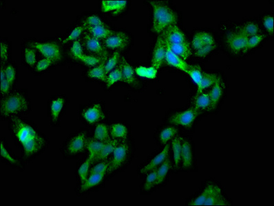 EIF3G Antibody - Immunofluorescence staining of HepG2 cells with EIF3G Antibody at 1:133, counter-stained with DAPI. The cells were fixed in 4% formaldehyde, permeabilized using 0.2% Triton X-100 and blocked in 10% normal Goat Serum. The cells were then incubated with the antibody overnight at 4°C. The secondary antibody was Alexa Fluor 488-congugated AffiniPure Goat Anti-Rabbit IgG(H+L).