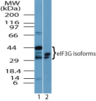 EIF3G Antibody - Western blot of eIF3G isoforms in 1) HeLa cell lysate and 2) RAW cell lysate using Polyclonal Antibody to eIF3G at 4.0 ug/ml.