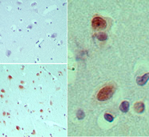 EIF3G Antibody - IHC ofeIF3G in formalin-fixed, paraffin-embedded human brain tissue using an isotype control (top left) and Polyclonal Antibody to eIF3G (bottom left, right) at5 ug/ml.
