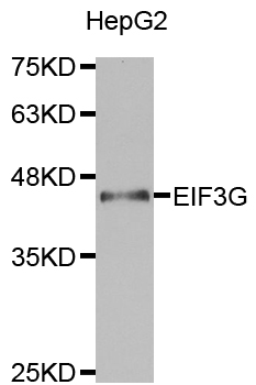 EIF3G Antibody - Western blot analysis of extracts of HepG2 cell lines, using EIF3G antibody.