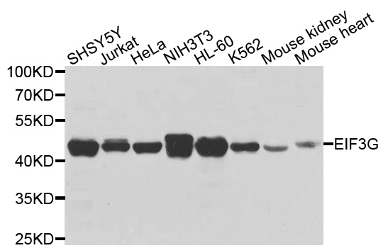 EIF3G Antibody - Western blot analysis of extracts of various cells.