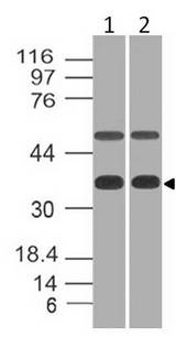 EIF3G Antibody - Fig-1: Western blot analysis of eIF3G. Anti-eIF3G antibody was used at 1 µg/ml on (1) K562 and (2) Hela lysates.