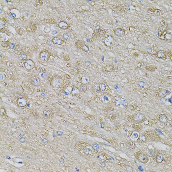 EIF3H / EIF3S3 Antibody - Immunohistochemistry of paraffin-embedded rat brain using EIF3H Antibody at dilution of 1:100 (40x lens).