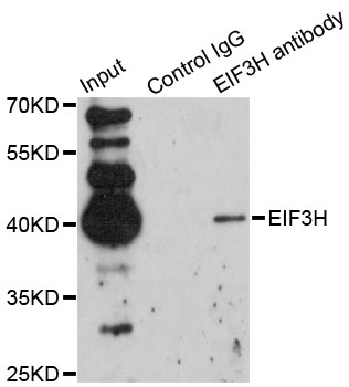EIF3H / EIF3S3 Antibody - Immunoprecipitation analysis of 200ug extracts of Jurkat cells using 1ug EIF3H antibody. Western blot was performed from the immunoprecipitate using EIF3H antibody at a dilition of 1:1000.