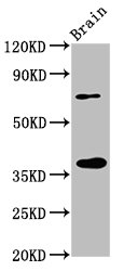 EIF3I / EIF3S2 Antibody - Western Blot Positive WB detected in: Rat brain tissue All lanes: EIF3I antibody at 3.2µg/ml Secondary Goat polyclonal to rabbit IgG at 1/50000 dilution Predicted band size: 37 kDa Observed band size: 37 kDa