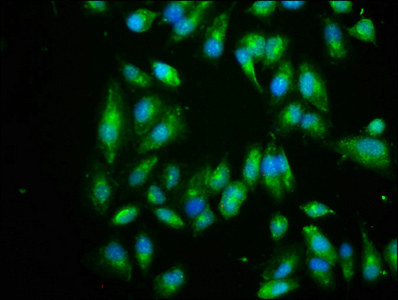 EIF3I / EIF3S2 Antibody - Immunofluorescence staining of Hela cells with EIF3I Antibody at 1:266, counter-stained with DAPI. The cells were fixed in 4% formaldehyde, permeabilized using 0.2% Triton X-100 and blocked in 10% normal Goat Serum. The cells were then incubated with the antibody overnight at 4°C. The secondary antibody was Alexa Fluor 488-congugated AffiniPure Goat Anti-Rabbit IgG(H+L).