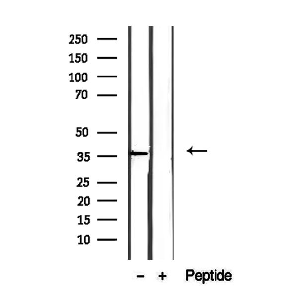 EIF3I / EIF3S2 Antibody - Western blot analysis of extracts of HEK293 cells using EIF3I antibody.