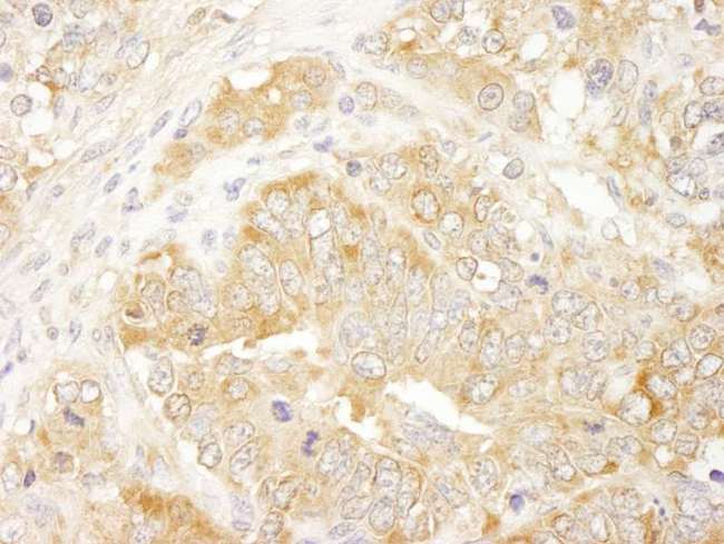 EIF3J Antibody - Detection of Mouse eIF3J/EIF3S1 by Immunohistochemistry. Sample: FFPE section of mouse teratoma. Antibody: Affinity purified rabbit anti-eIF3J/EIF3S1 used at a dilution of 1:100.