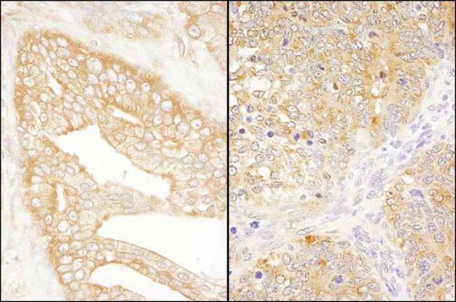 EIF3J Antibody - Detection of Human and Mouse eIF3J/EIF3S1 by Immunohistochemistry. Sample: FFPE section of human prostate carcinoma (left) and mouse teratoma (right). Antibody: Affinity purified rabbit anti-eIF3J/EIF3S1 used at a dilution of 1:1000 (1 Detection: DAB.