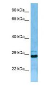 EIF3J Antibody - EIF3J antibody Western Blot of Jurkat cell lysate. EIF3J is strongly supported by BioGPS gene expression data to be expressed in Human Jurkat cells.  This image was taken for the unconjugated form of this product. Other forms have not been tested.