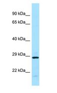 EIF3J Antibody - EIF3J antibody Western Blot of MCF7 cell lysate. EIF3J is strongly supported by BioGPS gene expression data to be expressed in Human MCF7 cells.  This image was taken for the unconjugated form of this product. Other forms have not been tested.