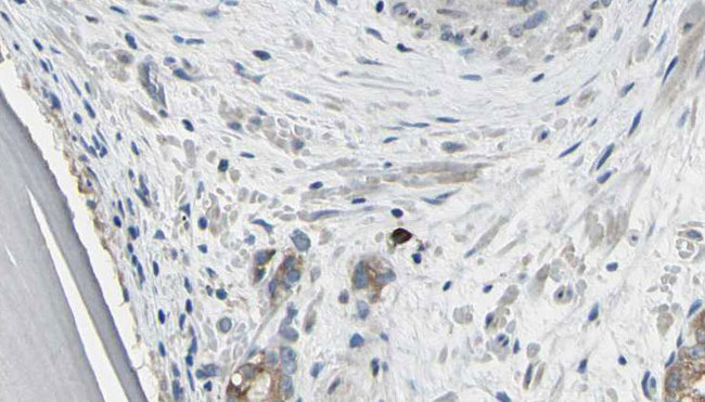 EIF3J Antibody - 1:100 staining human prostate tissue by IHC-P. The sample was formaldehyde fixed and a heat mediated antigen retrieval step in citrate buffer was performed. The sample was then blocked and incubated with the antibody for 1.5 hours at 22°C. An HRP conjugated goat anti-rabbit antibody was used as the secondary.