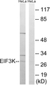 EIF3K Antibody - Western blot analysis of lysates from HeLa cells, using EIF3K Antibody. The lane on the right is blocked with the synthesized peptide.