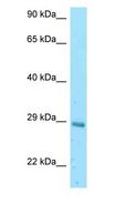 EIF3K Antibody - EIF3K antibody Western Blot of Mouse Liver.  This image was taken for the unconjugated form of this product. Other forms have not been tested.