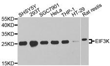 EIF3K Antibody - Western blot analysis of extracts of various cells.