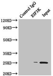 EIF3K Antibody - Immunoprecipitating EIF3K in HeLa whole cell lysate Lane 1: Rabbit monoclonal IgG(1ug)instead of product in HeLa whole cell lysate.For western blotting, a HRP-conjugated anti-rabbit IgG, specific to the non-reduced form of IgG was used as the Secondary antibody (1/50000) Lane 2: product(4ug)+ HeLa whole cell lysate(500ug) Lane 3: HeLa whole cell lysate (20ug)