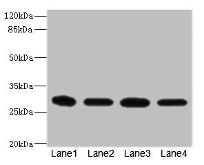 EIF3K Antibody - Western blot All Lanes: EIF3K antibody at 1.72ug/ml Lane 1: Thp-1 whole cell lysate Lane 2: HT29 whole cell lysate Lane 3: 293T whole cell lysate Lane 4: Hela whole cell lysate Secondary Goat polyclonal to rabbit IgG at 1/10000 dilution Predicted band size: 26,25 kDa Observed band size: 25 kDa