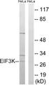 EIF3K Antibody - Western blot analysis of extracts from HeLa cells, using EIF3K antibody.