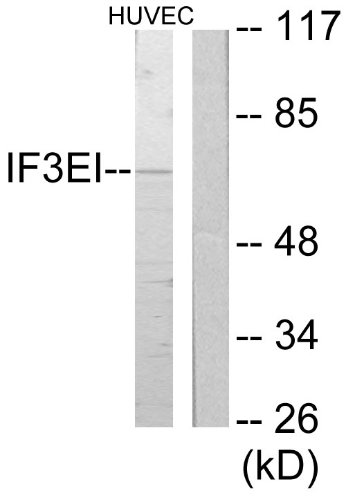 EIF3L / EIF3EIP Antibody - Western blot analysis of lysates from HUVEC cells, using IF3EI Antibody. The lane on the right is blocked with the synthesized peptide.