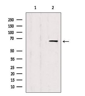 EIF3L / EIF3EIP Antibody - Western blot analysis of extracts of HepG2 cells using IF3EI antibody. Lane 1 was treated with the blocking peptide.