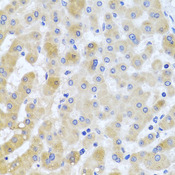 EIF3M / PCID1 Antibody - Immunohistochemistry of paraffin-embedded human liver injury tissue.