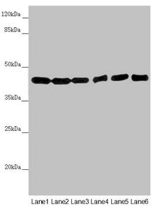 EIF3M / PCID1 Antibody - Western blot All Lanes:EIF3M antibody at 2.02 ug/ml Lane 1: Hela whole cell lysate Lane 2: A549 whole cell lysate Lane 3: Mouse gonadal tissue Lane 4: Human placenta tissue Lane 5: Mouse stomach tissue Lane 6: Mouse brain tissue Secondary Goat polyclonal to rabbit IgG at 1/10000 dilution Predicted band size: 43,28 kDa Observed band size: 43 kDa