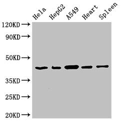 EIF3M / PCID1 Antibody - Western Blot Positive WB detected in:Hela whole cell lysate,HepG2 whole cell lysate,A549 whole cell lysate,Rat heart tissue,Rat spleen tissue All Lanes:EIF3M antibody at 2.7µg/ml Secondary Goat polyclonal to rabbit IgG at 1/50000 dilution Predicted band size: 43,28 KDa Observed band size: 43 KDa