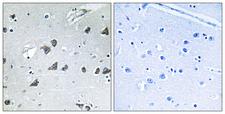 EIF3S5 / EIF3F Antibody - Immunohistochemistry analysis of paraffin-embedded human brain tissue, using EIF3F Antibody. The picture on the right is blocked with the synthesized peptide.