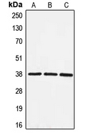 EIF3S5 / EIF3F Antibody - Western blot analysis of EIF3F expression in HeLa (A); HepG2 (B); NIH3T3 (C) whole cell lysates.