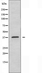 EIF3S5 / EIF3F Antibody - Western blot analysis of extracts of Jurkat cells using EIF3F antibody.