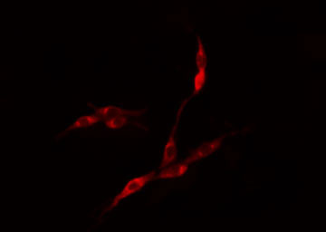 EIF3S5 / EIF3F Antibody - Staining COLO205 cells by IF/ICC. The samples were fixed with PFA and permeabilized in 0.1% Triton X-100, then blocked in 10% serum for 45 min at 25°C. The primary antibody was diluted at 1:200 and incubated with the sample for 1 hour at 37°C. An Alexa Fluor 594 conjugated goat anti-rabbit IgG (H+L) antibody, diluted at 1/600, was used as secondary antibody.