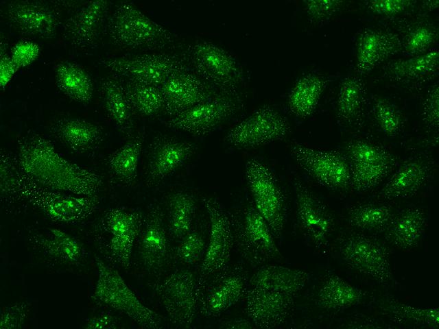 EIF3S5 / EIF3F Antibody - Immunofluorescence staining of EIF3F in U2OS cells. Cells were fixed with 4% PFA, permeabilzed with 0.1% Triton X-100 in PBS, blocked with 10% serum, and incubated with rabbit anti-Human EIF3F polyclonal antibody (dilution ratio 1:200) at 4°C overnight. Then cells were stained with the Alexa Fluor 488-conjugated Goat Anti-rabbit IgG secondary antibody (green). Positive staining was localized to Nucleus and cytoplasm.