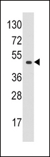 EIF4A1 Antibody - Western blot of anti-EIF4A1 antibody in K562 cell line lysates (35 ug/lane). EIF4A1(arrow) was detected using the purified antibody.
