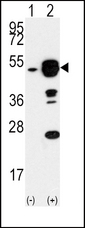 EIF4A1 Antibody - Western blot of EIF4A1 (arrow) using rabbit polyclonal EIF4A1 Antibody. 293 cell lysates (2 ug/lane) either nontransfected (Lane 1) or transiently transfected with the EIF4A1 gene (Lane 2) (Origene Technologies).