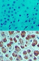 EIF4A1 Antibody - IHC of eIF4A1 in formalin-fixed, paraffin-embedded human liver tissue using an isotype control (top) and Polyclonal Antibody to eIF4A1 (bottom) at 5 ug/ml.