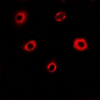 EIF4A1 Antibody - Immunofluorescent analysis of eIF4A1 staining in MCF7 cells. Formalin-fixed cells were permeabilized with 0.1% Triton X-100 in TBS for 5-10 minutes and blocked with 3% BSA-PBS for 30 minutes at room temperature. Cells were probed with the primary antibody in 3% BSA-PBS and incubated overnight at 4 deg C in a humidified chamber. Cells were washed with PBST and incubated with a DyLight 594-conjugated secondary antibody (red) in PBS at room temperature in the dark.