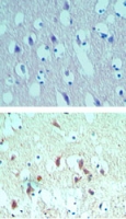 EIF4A2 Antibody - IHC ofeIF4A2 in paraffin-embedded formalin-fixed human brain tissue using an isotype control (top) and Polyclonal Antibody to eIF4A2 (bottom) at 5 ug/ml.