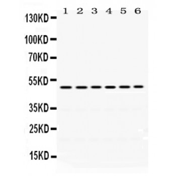 EIF4A2 Antibody - eIF4A2 antibody Western blot. All lanes: Anti eIF4A2 at 0.5 ug/ml. Lane 1: Rat Liver Tissue Lysate at 50 ug. Lane 2: Rat Thymus Tissue Lysate at 50 ug. Lane 3: Rat Kidney Tissue Lysate at 50 ug. Lane 4: HELA Whole Cell Lysate at 40 ug. Lane 5: SGC Whole Cell Lysate at 40 ug. Lane 6: 22RV1 Whole Cell Lysate at 40 ug. Predicted band size: 49 kD. Observed band size: 49 kD.