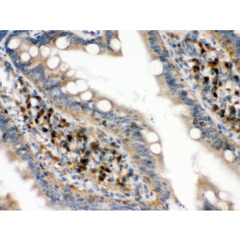 EIF4A2 Antibody - eIF4A2 antibody IHC-paraffin. IHC(P): Rat Intestine Tissue.