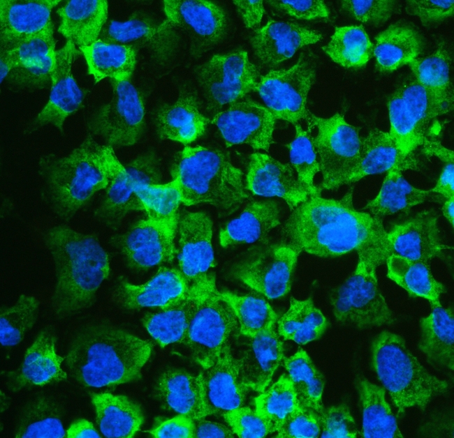 EIF4A2 Antibody - IF analysis of eIF4A2 using anti-eIF4A2 antibody eIF4A2 was detected in immunocytochemical section of A431 cell. Enzyme antigen retrieval was performed using IHC enzyme antigen retrieval reagent for 15 mins. The tissue section was blocked with 10% goat serum. The tissue section was then incubated with 2µg/mL rabbit anti-eIF4A2 Antibody overnight at 4°C. DyLight®488 Conjugated Goat Anti-Rabbit IgG was used as secondary antibody at 1:100 dilution and incubated for 30 minutes at 37°C. The section was counterstained with DAPI. Visualize using a fluorescence microscope and filter sets appropriate for the label used.