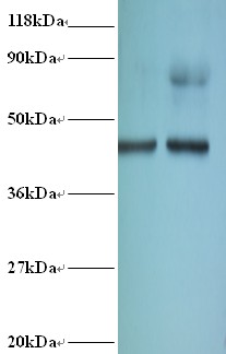 EIF4A2 Antibody - Western blot of Eukaryotic initiation factor 4A-II antibody at 2 ug/ml. Lane 1: EC109whole cell lysate. Lane 2: 293T whole cell lysate. Secondary: Goat polyclonal to Rabbit IgG at 1:15000 dilution. Predicted band size: 45 kDa. Observed band size: 45 kDa. This image was taken for the unconjugated form of this product. Other forms have not been tested.