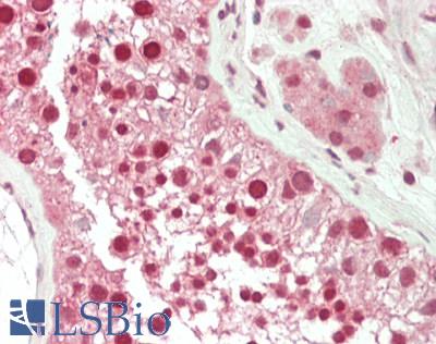EIF4A2 Antibody - Human Testis: Formalin-Fixed, Paraffin-Embedded (FFPE).  This image was taken for the unconjugated form of this product. Other forms have not been tested.